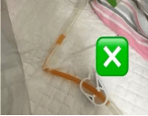 梗阻性黄疸放置引流管，居家如何护理？